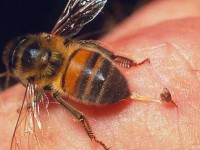 Как избавиться от опухоли после укуса пчелы