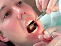 Лечение зубов и другие стоматологические процедуры